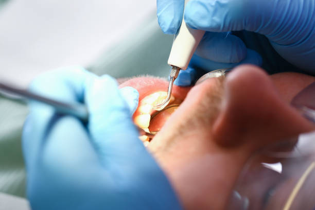 Best Emergency Tooth Extraction  in Freeman, SD